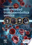 Compendio de enfermedad tromboembólica venosa