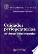 Cuidados perioperatorios en cirugía cardiovascular