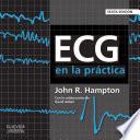 ECG en la práctica